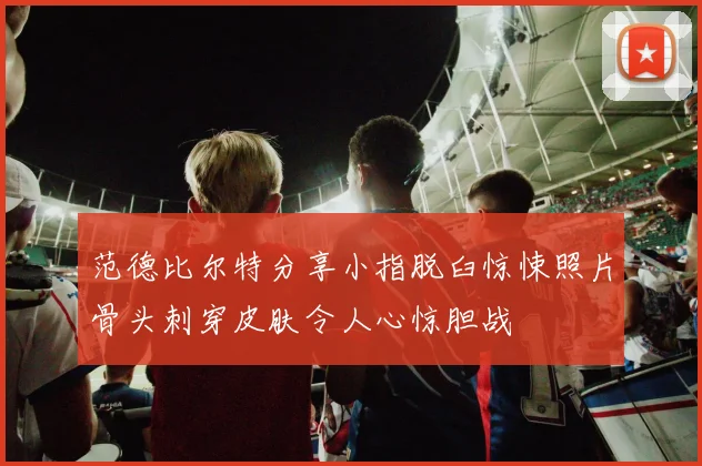 范德比尔特分享小指脱臼惊悚照片骨头刺穿皮肤令人心惊胆战